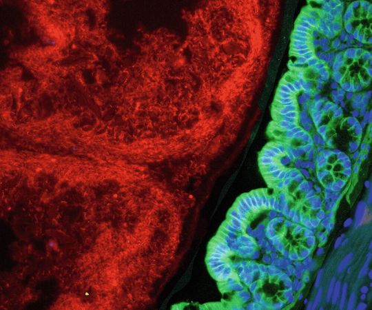 Mikroskopische Aufnahme von Darmgewebe. Grün: Epithelzellen, die HK2 produzieren. Rot: Bakterien im Inneren des Darmes. Mikroskopische Aufnahme von Darmgewebe. Grün: Epithelzellen, die HK2 produzieren. Rot: Bakterien im Inneren des Darmes.