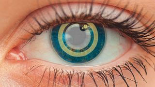 Nach einer minimal-invasiven Implantation überwacht der Mikrosensor kontinuierlich den Augeninnendruck bei Grünem-Star-Erkrankungen. (Bild: Cicor)