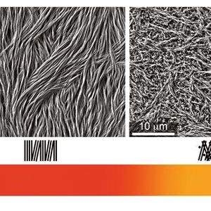 Die Elektronenmikroskop-Aufnahmen zeigen die innere Struktur des Zahnschmelzes von außen (links) nach innen (rechts). In der äußeren Schicht sind die Apatit-Bündel parallel angeordnet, in der mittleren Schicht sind sie bereits leicht miteinander verwoben und im inneren Zahnschmelz bilden die Bündel eine stark verwobene Struktur. Die Zahnschmelzschichten sind farbcodiert auch noch schematisch dargestellt. Aufgrund der unterschiedlichen Eigenschaften bricht vor allem der äußere Zahnschmelz ab, und die spitze Form des Zahns bleibt erhalten (rechts unten).(Bild:  © Max-Planck-Institut für Kolloid- und Grenzflächenforschung/Nature Communications 2020)