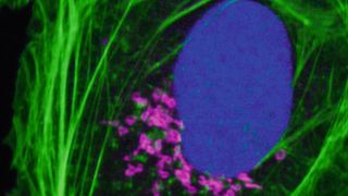 Abb. 2: Drei verschiedene Sonden (Phalloidin, Azid und Antikörper) wurden mit demselben Fluoreszenzfarbstoff (ATTO 488) markiert, wodurch drei Zellstrukturen sichtbar gemacht werden konnten: Das Aktin-Zellskelett (grün), die DNA im Zellkern (blau) und der so genannte Golgi-Apparat (magenta). Dieses Ergebnis hebt die extrem hohe Sensitivität des sFLIM-Verfahrens hervor. (Bild: modifiziert nach Niehörster et al., Nature Methods 2016 [1])