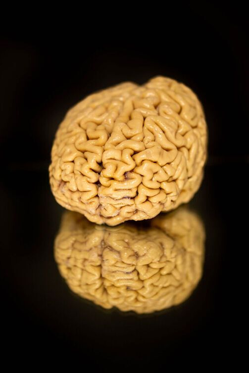 A donated Super Ager brain.  (Source:  Shane Collins, Northwestern University)