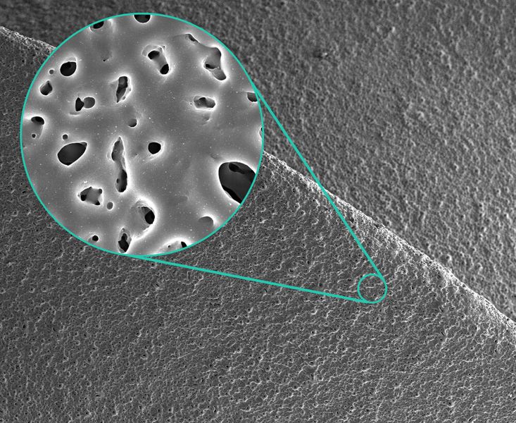 Scanning electron microscope image of a silver-doped porous micro-arc oxide layer on titanium. (Image:Fraunhofer IFAM)