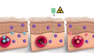 Residente T-Zellen (lila) überleben bei manchen Patienten Bestrahlung und Chemotherapie. Spenderzellen (pink und grün) sind dann hauptsächlich im Blut zu finden. (Bild: Daniela Leitner/Science Immunology)