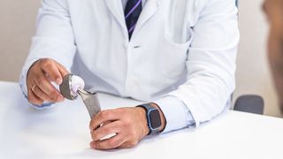 Hüftoperationen sind mittlerweile zu einem Standardeingriff geworden. Doch bei vielen Patientinnen und Patienten entwickeln die Hüftprothesen im Nachgang Probleme.  (Bild: © Sylvie Pabion Martín - stock.adobe.com)
