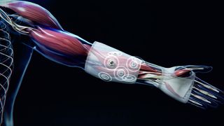 Eine koordinierte Stimulation der Mikroimplantate unterstützt bei der Ausführung von Handbewegungen. (Bild: Wilddesign GmbH, Gelsenkirchen)