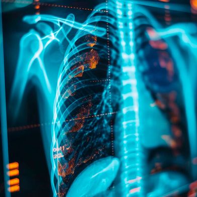 Beim Lungenkrebs-Screening für starke Rauchende müssen Fachärzte die CT-Aufnahmen laut KBV „mit Unterstützung einer geeigneten Software befunden“. (Bild: © Peopleimages - AI - stock.adobe.com / KI-generiert)