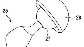 Ein Verfahren zur Oberflächenbehandlung eines Implantats. (DPMA)