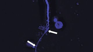 Eosinophile Granulozyten sind in der Lage, DNA-Netze auszuschütten und Mikrofilarien damit einzufangen. Die Fluoreszenzmikroskopieaufnahme zeigt, wie eine Mikrofilarie (oben) von den DNA-Netzen (blau angefärbt, Pfeile) der Eosinophilen Granulozyten (rundliche Strukturen) eingefangen wird. (Alexandra Ehrens)