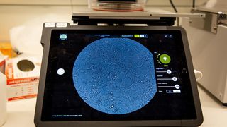 Nichtinfizierte HEK-293-Zellen unter dem Mikroskop: Diese Linie aus menschlichen embryonalen Nierenzellen ist im Labor vergleichsweise einfach zu handhaben. (© Felix Petermann, MDC )