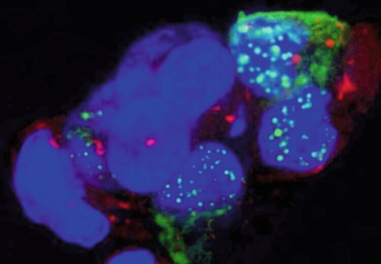 The green dots are protein aggregates in the cell nuclei. In cells that appear solid blue, no aggregates have formed (yet).