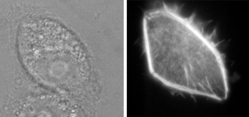Abb.2: Eine Glaspipette injiziert leuchtfähige Moleküle in eine Nierenzelle (Bild links). Wenige Sekunden später leuchten die Moleküle und lassen neue Details erkennen (Bild rechts). (Uni Bielefeld)