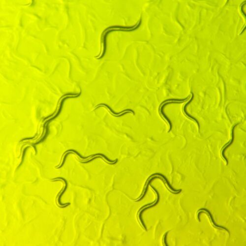 Humans and the tiny worms known as C. elegans nematodes share many of the same genes, including those affected by the rare childhood disease AHC. (Source:  Diana Wall/Brown University)