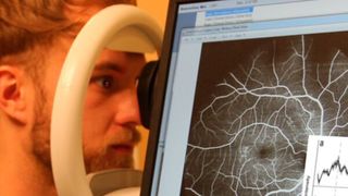 Ein europäisches Forscherteam baut ein Gerät, an dem Patienten ihr Auge berührungsfrei abrastern lassen können und wenige Minuten später eine Diagnose erhalten. (Ewald Unger/ Medizinische Universität Wien)