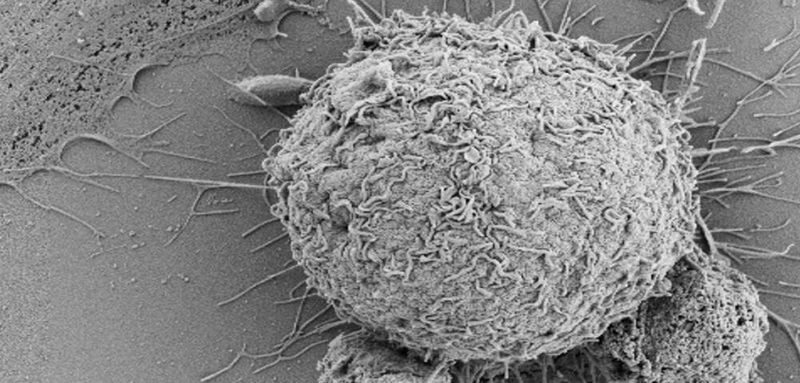 Two Oxford teams were investigating the ‘Mucosal Associated Invariant T cells’, or ‘MAIT cells’ for short, which were only identified in the last few years. (University of Oxford)