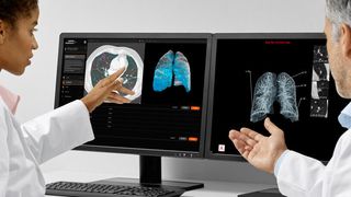 AI-Rad Companion Chest CT ist eine auf künstlicher Intelligenz (KI) basierende Software für die Computertomografie (CT). Die zugrundeliegenden Algorithmen wurden in Wissenschaftsteams bei Siemens Healthineers anhand von umfangreichen klinischen Datensätzen trainiert. (Siemens Healthineers)