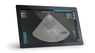 ultraschall-diagnose-hmi ()