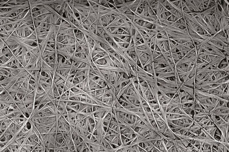 The membrane is made of cellulose fibres with a diameter of a few dozen nanometres (electron microscope image).  (Robotti F et al. Biomaterials 2019)