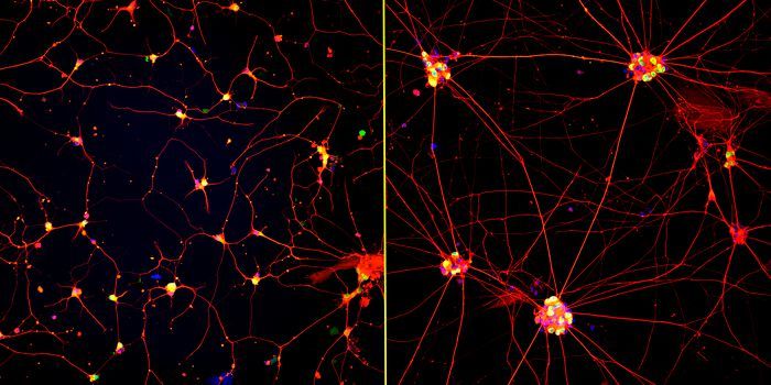 Fluorescent images of human neurons (stained with red, green and blue) growing on coatings with fast-moving molecules (left) or conventional laminin (right) for 72 hours. Neurons attached and spread homogenously on the highly mobile coating but remained clumped together on the laminin coating. (Source: Northwestern University)