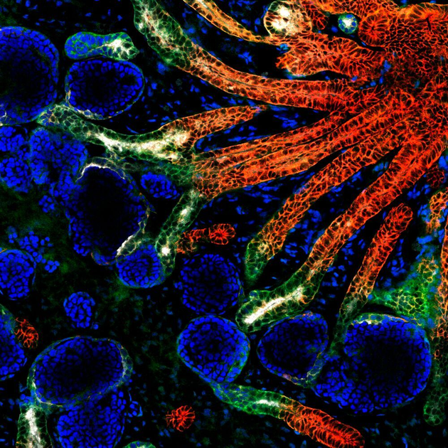 Scientists Grow Mini Kidneys from Stem Cells