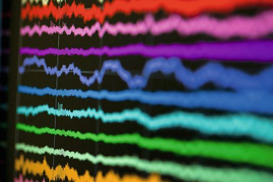 Manche Neurone im Gehirn - werden spezifisch bei Additions-Aufgaben aktiv, andere bei Subtraktionen.(Bild:  © Christian Burkert/Volkswagen-Stiftung/Uni Bonn)