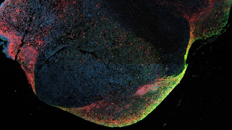 Mithilfe von Hirnorganoiden haben Forschende wertvolle Einblicke in die Mechanismen gewonnen, wie sich das Ebola-Virus im Zentralnervensystem verstecken und dort persistieren kann.(Bild:  ©BNITM | Lina Widerspick)