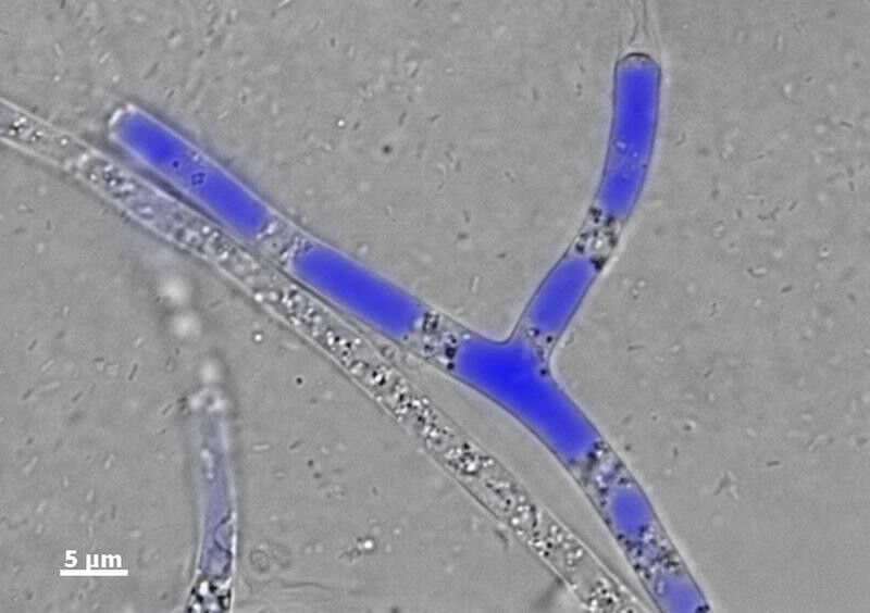 Abb. 2: Mikroskopische Aufnahme des Myzel-bildenden Boden Mikroorganimus Pythium ultimum welcher Phenanthren in seinem Zellinnern transportiert: Overlay eines Durchlicht- und Fluoreszenzbildes von Pythium ultimum, dessen Hyphen Phenanthren-angereicherte Vesikel (in blau) enthalten. (Bild: Susan Foß/UFZ)