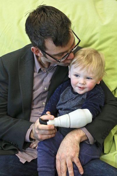 When he didn't want to wait for the arm prosthesis for his son, Ben found a quicker and cheaper option by himself. (Ambionics)