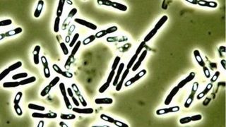 Bakterien der Art Bacillus cereus unter dem Mikroskop. Die weißen Einschlüsse in den stäbchenförmigen Bakterien sind Sporen, die auch bei Hitze überleben. (Bild: TUM/H. Seiler)