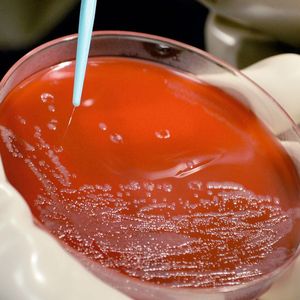 Kultivierung des Pest- Erregers im Biologischen Sicherheitslabor (BSL-3) als versuchsvorbereitende Maßnahme zur Untersuchung der Inaktivierung von Yersinia pestis durch massives metallisches Kupfer.