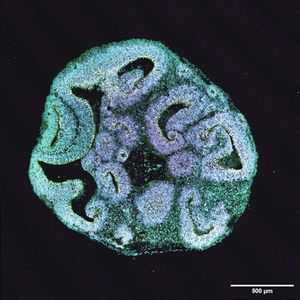 Ein menschliches Hirnorganoid(Bild:  Indra Niehaus, Medizinische Hochschule Hannover)