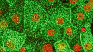 In den Nierenzellen der Ratte befindet sich das grün markierte Aquaporin AQP2 im Zellinneren, wenn sie weder durch das Hormon noch durch ein Medikament stimuliert wurden. Zellkerne erscheinen rot. (AG Klussmann, MDC)