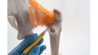 Die Stabilität eines Knochens hängt nicht nur von seiner Dichte ab, sondern auch von der Orienteierung der Kollagenfasern, aus denen er besteht (Symbolbild). (Bild: © shidlovski - stock.adobe.com)