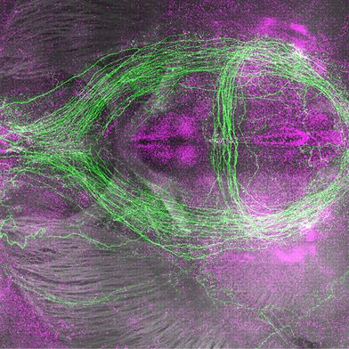 Schlaffördernde Neuronen (grün) und kürzlich aktivierte Neuronen (magenta) im Mausgehirn.  (Bild: William Joo, Biozentrum, Universität Basel)