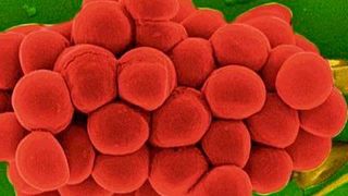 Die rasterelektronenmikroskopische Aufnahme zeigt Zellen des Eiter-Erregers Staphylococcus aureus. Bakterien dieser Spezies verursachen beispielsweise Wundinfektionen. (Copyright: Helmholtz-Zentrum für Infektionsforschung HZI)