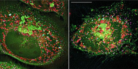 Zwei fluoreszenmikroskopische Aufnahmen: Das Protein Arf1 (grün) sorgt an der Kontaktstelle zwischen Mitochondrium (rot) und Lipidtröpfchen (türkis) dafür, dass Lipide in die Mitochondrien geschleust werden, wo sie in den Energiespender ATP umgewandelt werden.(Bild:  Universität Basel, Biozentrum)