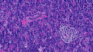 Zellen der Bauchspeicheldrüse, die Insulin produzieren (Mitte). Weisse Blutzellen, die diese schädigen und damit Diabetes auslösen, können auch autoimmune Krankheiten im Darm verursachen. (© Universität Bern/Inselspital, Universitätsspital Bern)