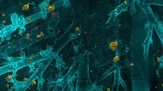 Dem Feind auf der Spur: Der von Helmholtz Zentrum München, LMU und TUM entwickelte KI-Algorithmus DeepMACT ist in der Lage, kleinste Metastasen zu erkennen, hier in einzelnen disseminierter Zellen einer Maus-Lunge. DeepMACT ist eines von mehreren KI-Projekten, welche die Früherkennung und Behandlung von Krebserkrankungen wesentlich verbessern sollen. (Bild: Helmholtz Zentrum München)