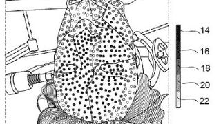 Medizinisches System sowie Verfahren zur Überprüfung einer Registrierungsgenauigkeit (Bild: B. Braun New Ventures GmbH/DPMA)