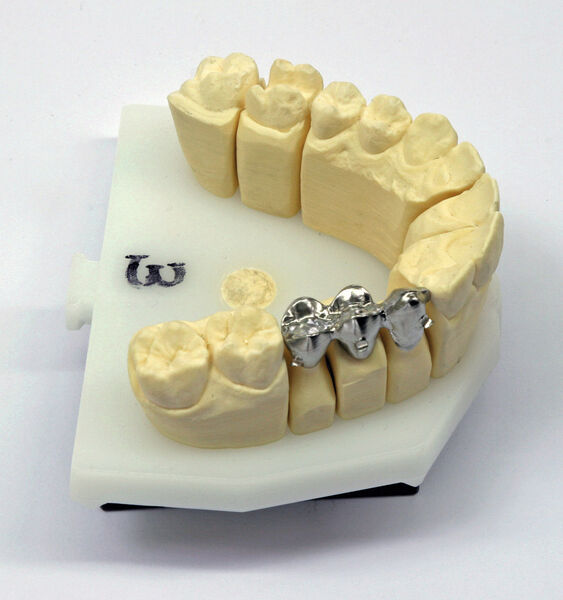 Personifizierte Zahnkappen ab Maschine. (Bild: Agie Charmilles)