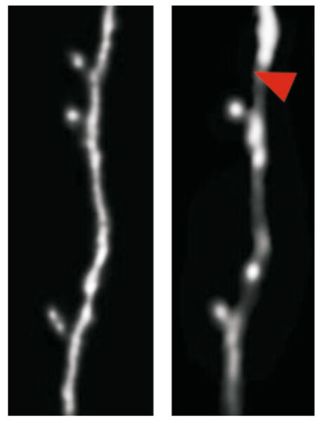 Ein Dornfortsatz (ca. 1 Mikrometer im Durchmesser) einer Großhirnnervenzelle einer lernenden Maus wird abgebaut. Zwei Bilder an zwei verschiedenen Tagen (roter Pfeil: fehlender Dornfortsatz) (Ausschnitt). (Bild: Hertie-Institut für klinische Hirnforschung (HIH))