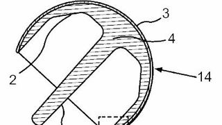 Eine Endoprothese, Verfahren zu deren Herstellung und Verwendung einer Endoprothese. (Bild: DPMA)