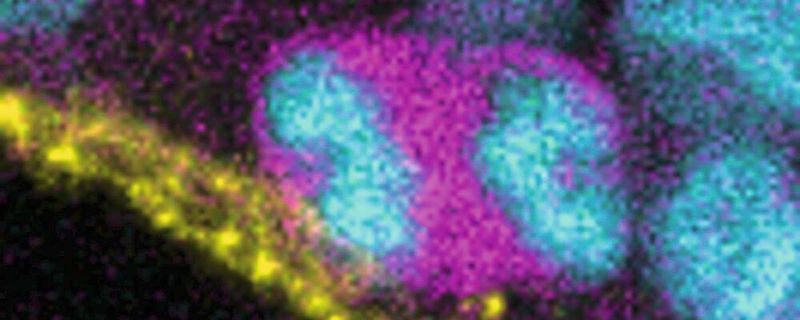 Eine sich teilende Zelle eines menschlichen Hirnorganoids(Bild:  Indra Niehaus, Medizinische Hochschule Hannover)