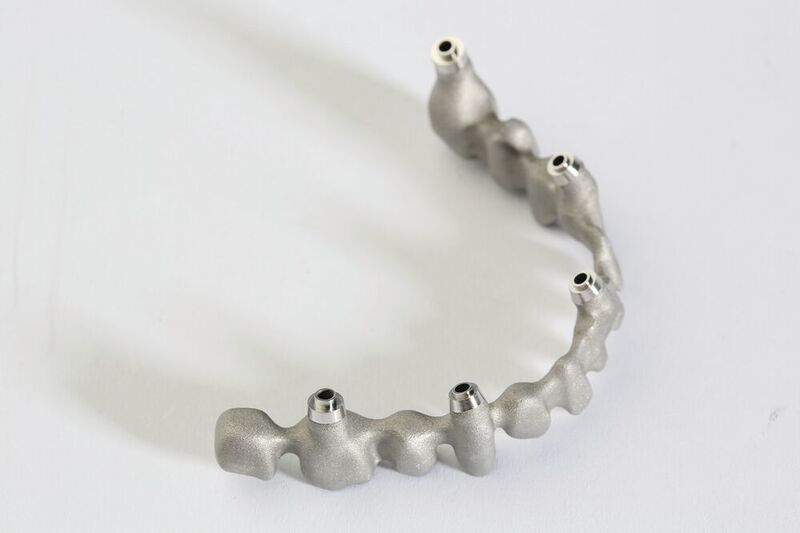 GF Machining Solutions zeigt außerdem 3D-Metalldruck-Anwendungen für patientenspezifische Zahnbrücken, fertiggestellt mit den passenden sowie absolut hygienischen Nachbearbeitungsverfahren. (GFAC)