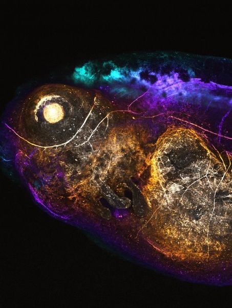  Zelle oder Galaxie?   KI trifft auf CRISPR und legt damit den Grundstein für eine neue Generation von Gentherapien.  Ein Forscherteam der Universität Zürich hat eine leistungsstarke neue Methode zur präzisen Editierung von DNA entwickelt, die modernste genetische Engineering-Techniken mit künstlicher Intelligenz kombiniert. Diese Technik eröffnet die Möglichkeit für genauere Modelle menschlicher Erkrankungen und legt den Grundstein für Gentherapien der nächsten Generation.   Mit dem KI-Tool „Pythia“ können Wissenschaftler voraussagen, wie Zellen ihre DNA reparieren, nachdem sie von Werkzeugen wie CRISPR/Cas9 geschnitten wurde. Durch die Nutzung vorhersehbarer Reparaturmuster soll das Risiko unerwünschter genetischer Veränderungen minimiert werden. Damit hat das Verfahren das Potenzial, sowohl in der Biotechnologie als auch in der Gentherapie Anwendung zu finden.  Nach erfolgreichen Tests in menschlichen Zellkulturen wurde die Methode auch in anderen Organismen, einschließlich der Frösche Xenopus und lebenden Mäusen, erprobt.   Auf dem Bild zu sehen ist ein fluoreszenzmarkiertes neuronales Molekül, das in einer lebenden Kaulquappe abgebildet wurde, wobei die Farben die Bildtiefe darstellen. Das Gehirn und die Spinalnerven erscheinen oben in Türkis bis Violett, und der Verlauf der peripheren Nerven ist im gesamten Körper der Kaulquappe sichtbar.   Hier gehts zur Originalmeldung Wissenschaftsbild des Tages vom 21.8.2025  (Bild: Taiyo Yamamoto, University of Zurich)