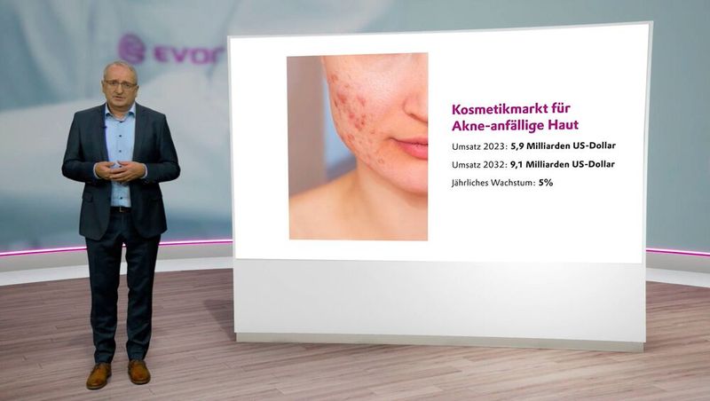 Das neue Hautmikrobiom-Modell lässt sich auch für Akne-anfällige Haut anwenden. (Bild: VCG)