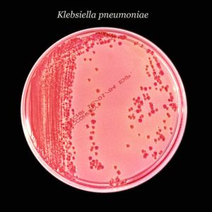 (Centers for Disease Control and Prevention)