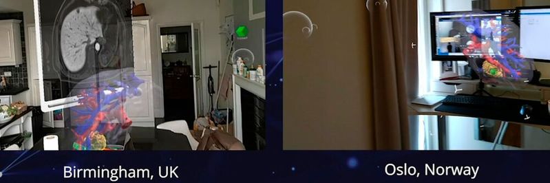 Aus Standard-CT- und -MRT-Bildern werden Hologramme geschädigter Organe erstellt. Diese können bei Planungsbesprechungen zwischen Medizinern verschiedener Abteilungen verwendet werden, damit diese sich nicht persönlich treffen müssen. (Bild:  HoloCare)