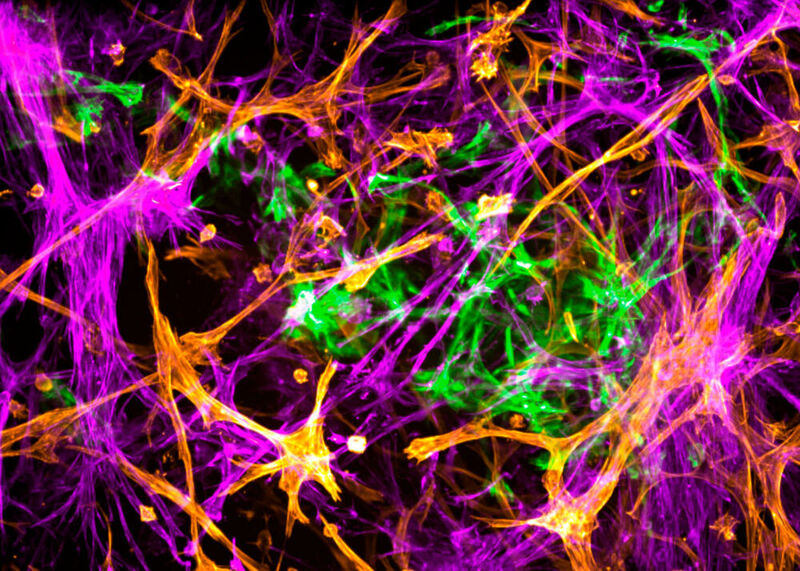 Neuron-D nutzt dreidimensionale Zellkulturen, um Wirkstoffkandidaten für die Behandlung neurodegenerativer Erkrankungen zu testen. (DZNE/ Kizil Lab)
