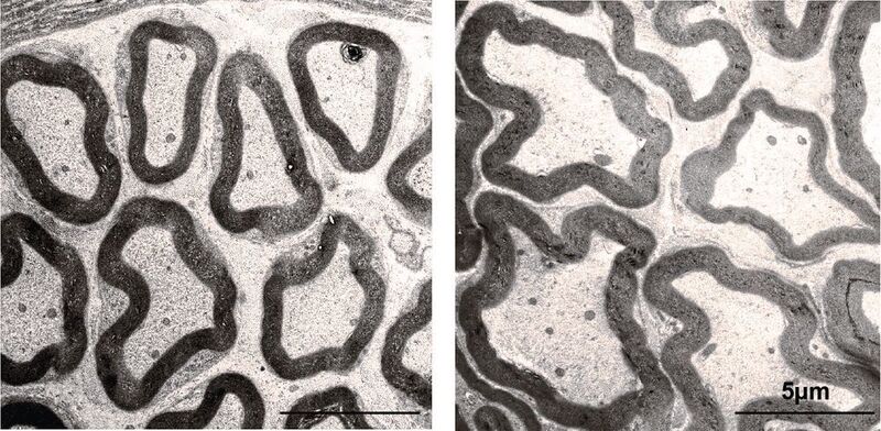 Elektronenmikroskopische Aufnahme von Axonen im Querschnitt. Mäuse, denen das Gen CMTM6 fehlt (rechts), besitzen dickere Axone als Tiere mit funktionierendem Gen (links).  (MPI f. experimentelle Medizin/ Möbius)