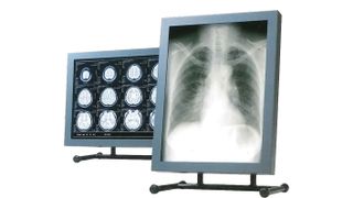 Das von JVC Kenwood entwickelte LCD-Display setzte vor 25 Jahren neue Standards bei der medizinischen Bildgebung. (Bild: JVC Kenwood)